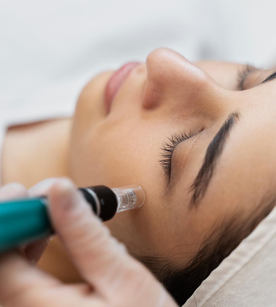 Micro-
Needling