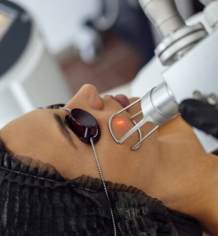 Acne
Scar Treatment